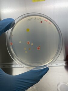 A gloved hand holds a circular petri dish. There are different coloured colonies on the dish.
